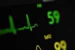L’importance de l’ECG en médecine